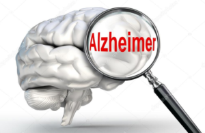 imagem de um cérebro com uma lupa na palavra Alzheimer