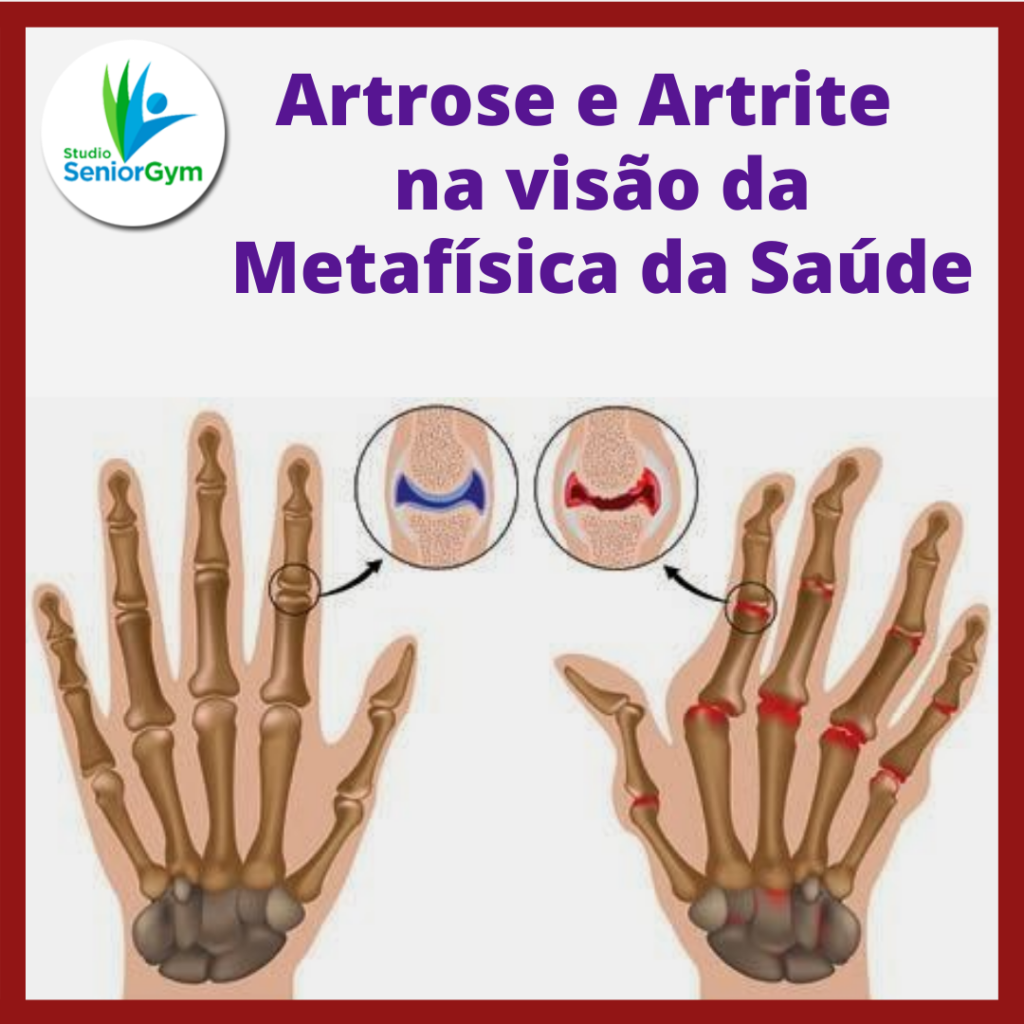 Artrose e Artrite na visão da Metafísica da Saúde Clínica Senior Gym Artrose e Artrite na visão da Metafísica da Saúde Clínica Senior Gym